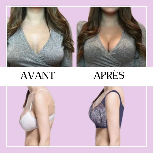 Comflit | Soutien-Gorge Sans Armature